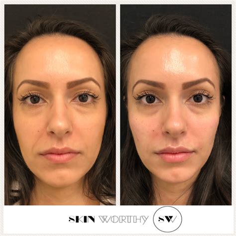 Transformation Thursday: Inspiring Stories of Skin-Worthy Transformations