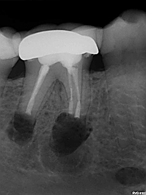 endo-surgery-2 - A2 Endodontics