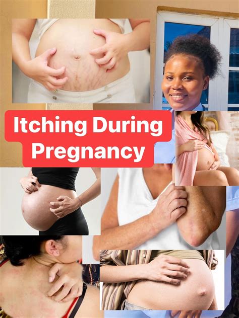 Midwife - WHY AM I ITCHING SO MUCH DURING PREGNANCY? HERE’S WHAT YOU