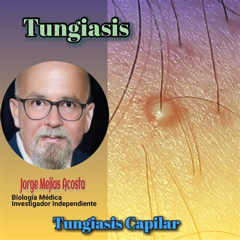 Tungiasis Argentina - Tungiasis Expansiva. Padecimiento crónico e