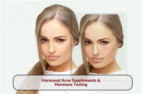 Hormonal Acne Supplements & Hormone Testing - Red Leaf Wellness