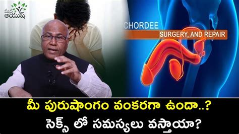 health tips  men   treatment  penile curvature bent