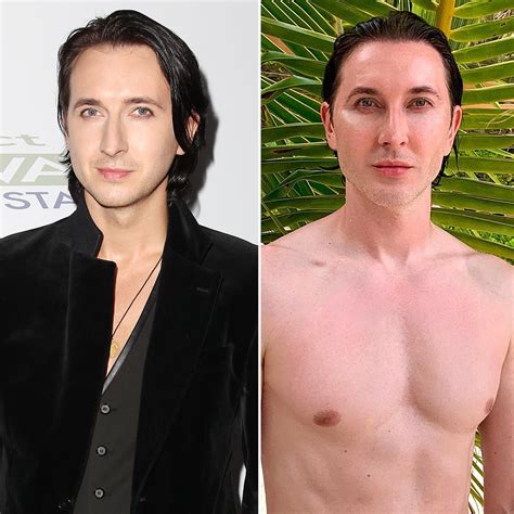 Unlocking The Enigma Of Dmitry Sholokhov Face Surgery Separating Fact From Fiction