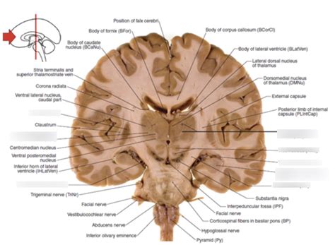 coronal cross section  brain  diagram quizlet