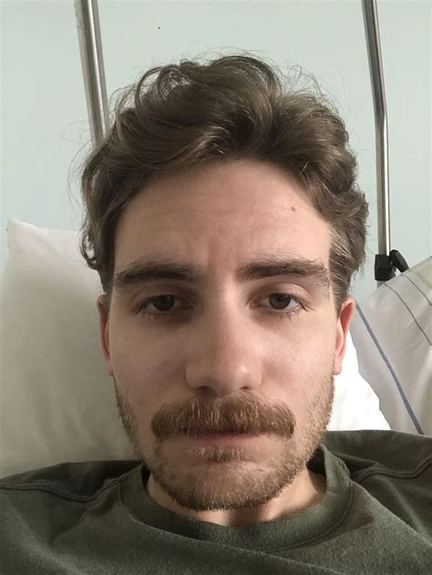 My skiing season is over due to a broken leg but the stache keeps