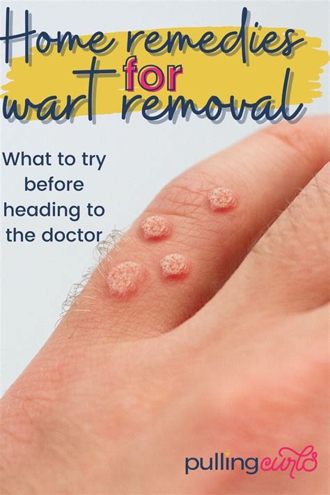 How to get rid of warts DIY at Home using essential oils! | Home remedy ...