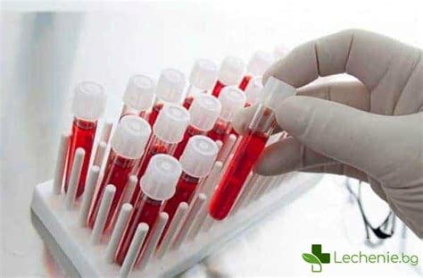 ᐉ Повишени моноцити при деца - за какво сигнализират — Lechenie.bg