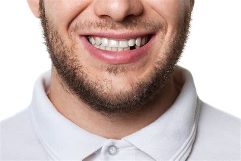 missing  tooth discover  options     tooth loss