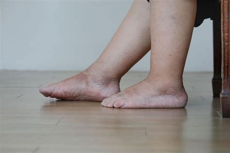 understanding leg pain common   treatment options