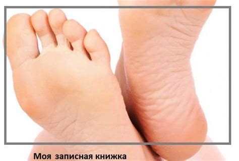 Диабет - страшное заболевание, но еще опаснее его осложнения. К одному ...