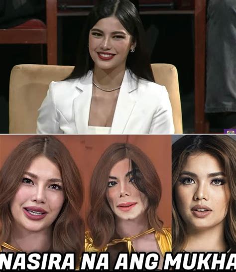 SHOCKING TRANSFORMATION! Jane De Leon Unrecognizable After Alleged