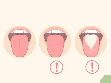Como Limpar A Lingua Corretamente - Como Limpar a sua Língua Corretamente: 11 Passos