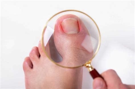 Pain In The Big Toe | The Footcare Clinic