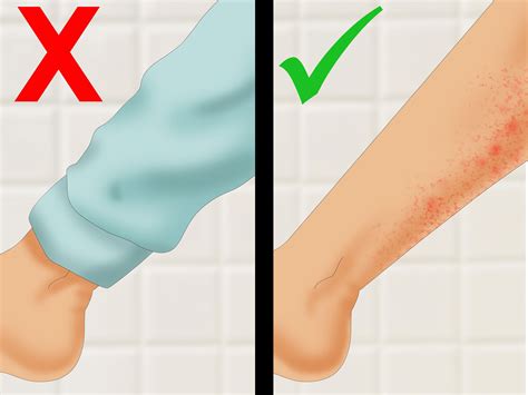 How To Get Rid Of Electric Razor Burn at Gwen Mayer blog