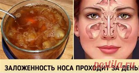 Замечательное средство от заложенного носа. Будете свободно дышать у ...