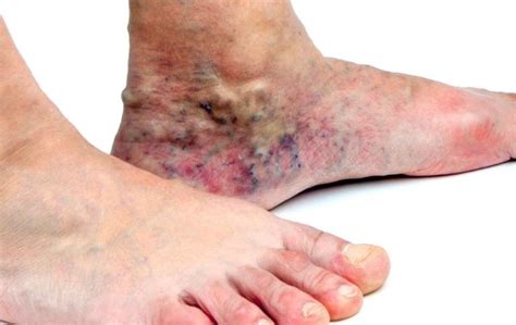The Underlying Cause Of Skin Discoloration