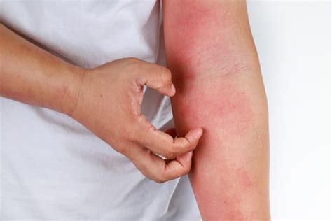 skin treatment  singapore  dermatology clinic