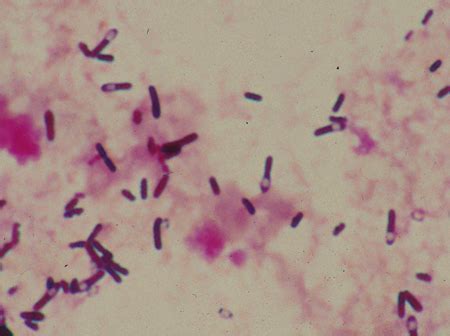 Lancet Shaped Streptococcus Pneumoniae