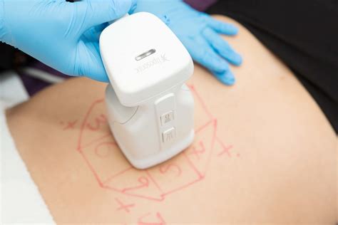 Does Non-surgical Fat Removal Work? | Skin To Love Clinic