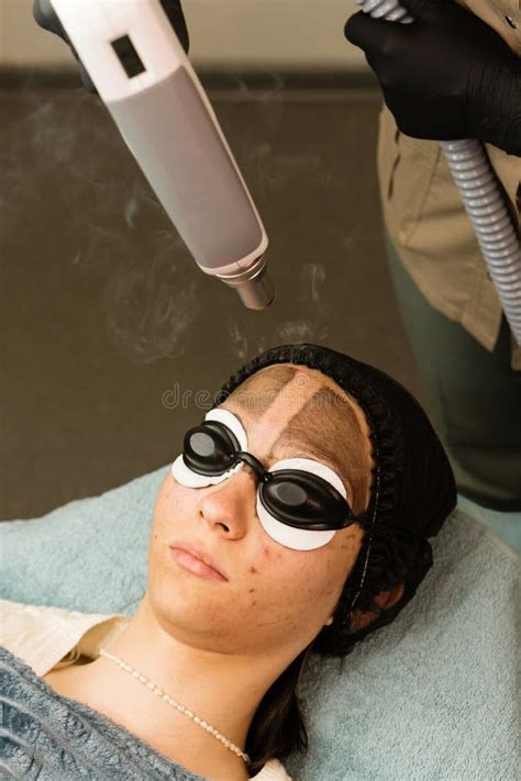 Carbon face peeling stock image. Image of medical, adult - 277007957