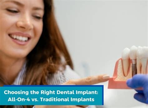 Choosing the Right Dental Implant: All-On-4 vs. Traditional Implants