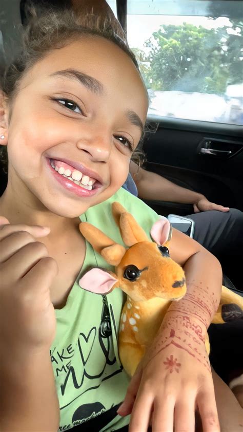 Aleyka has a lighter colored birthmark on the side of her face. She saw