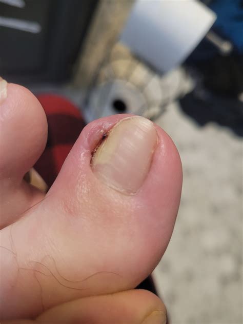 Is there anything I can do about this myself? I can't afford another