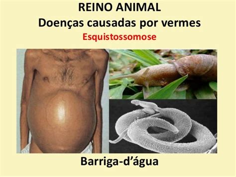 Doenças causadas por vermes