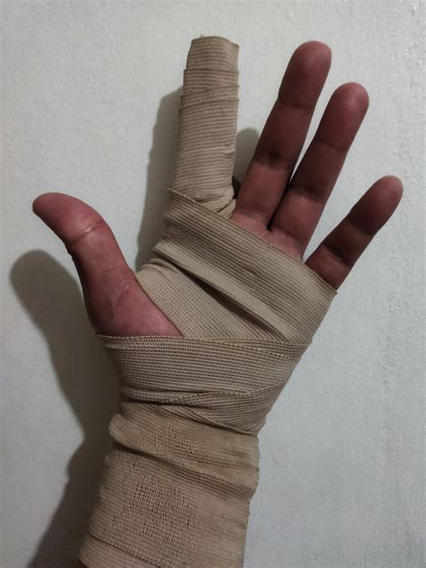 Sprained finger by ShinRiderNumber2 on DeviantArt