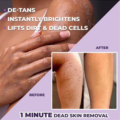 dead skin face remover 7