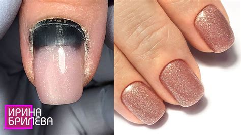 ПРИБИТЫЙ ноготь на руке 💅 Как можно СПАСТИ ситуацию 💅 Маникюр ДО и ...