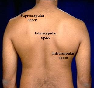 infraclavicular space  clavicle supraclavicular space