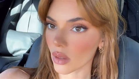 Kendall Jenner gets lip fillers? New photo leaves fans in shock!