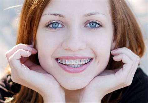 braces  adults braces   good   align teeth