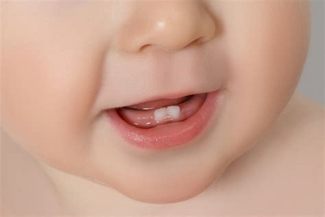 Bebe De 2 Meses Pode Nascer Dente - Nascimento dos primeiros dentes dos bebês - Auhe Kids