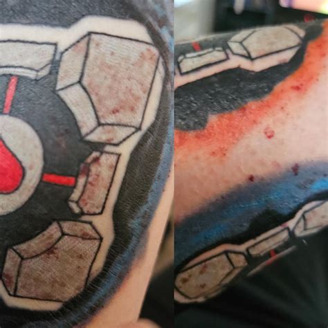 tattoo infection care 1