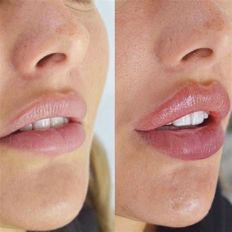 Foto de Instagram de Dr. Anni • 12 de marzo de 2019 a las 3:59 | Lip ...