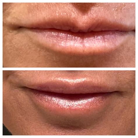 Dental Spa Indianapolis | Indianapolis IN