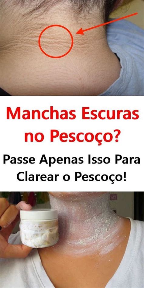 Como Clarear O Pescoço - Por Essa Ninguém Esperava, Usei PASTA DE DENTE Para Clarear o Pescoço ...