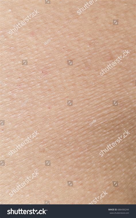 Skin Rashes That Allergic Sweat Cosmetics Stock Photo 686436244 ...