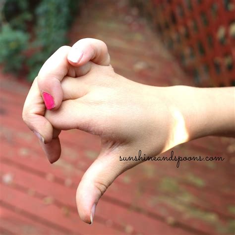 10 benefits of having ehlers danlos syndrome – Artofit