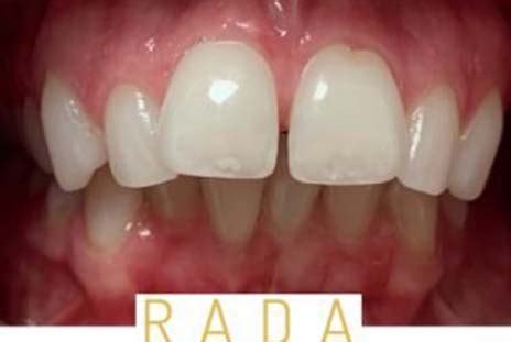 Tooth Talk | Dentist in Bolton, Staffordshire, Southport, Salisbury