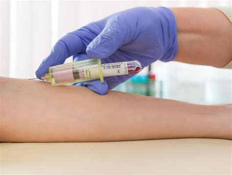 premium photo blood sampling   vein