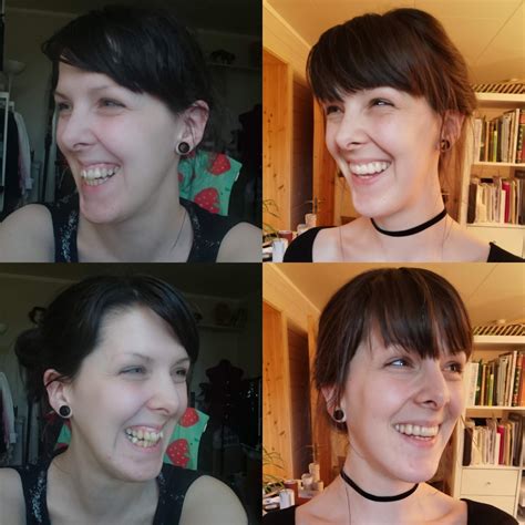 Can I Zyn After Wisdom Teeth Social Post Detail