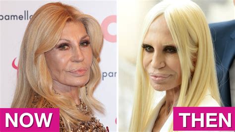 Pics reveal Donatella Versace’s new unrecognisable face: Best celeb ...