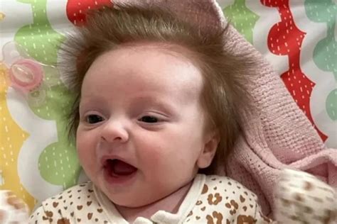Bebe Com Cabelo Arrepiado - Bebê tem cabelo arrepiado em todas as direções e mãe fala sobre o ...