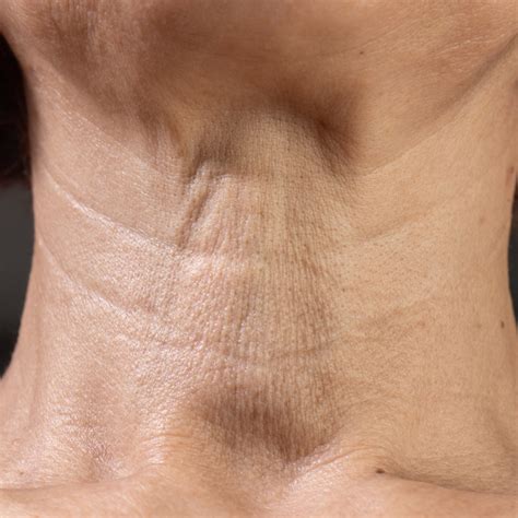 effective  surgical neck tightening procedures