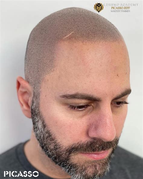 Picasso Jeff | Scalp Micropigmentation Experts in California