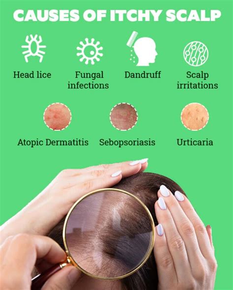 scalp irritation nhs itchy scalp  treatments  prevention