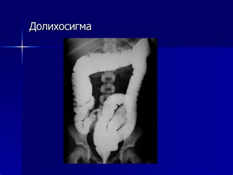 Лучевая диагностика заболеваний органов желудочно-кишечного тракта ...